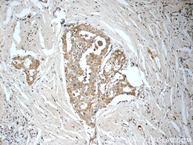 WNT5A/B Antibody in Immunohistochemistry (Paraffin) (IHC (P))