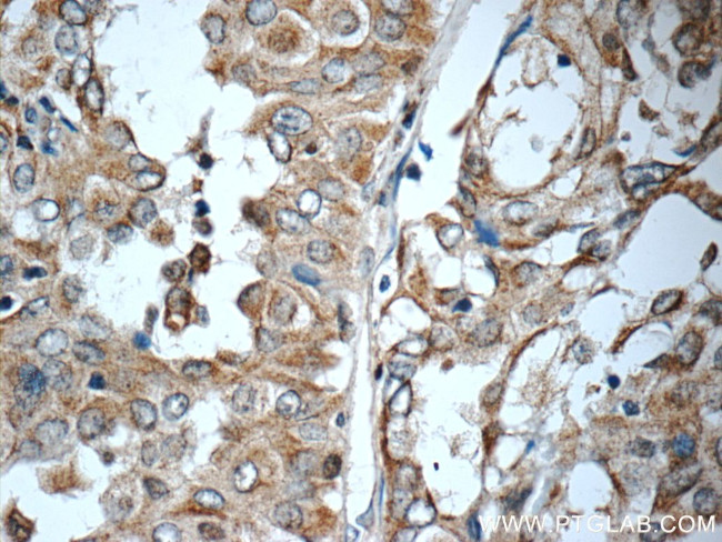 WNT5A/B Antibody in Immunohistochemistry (Paraffin) (IHC (P))