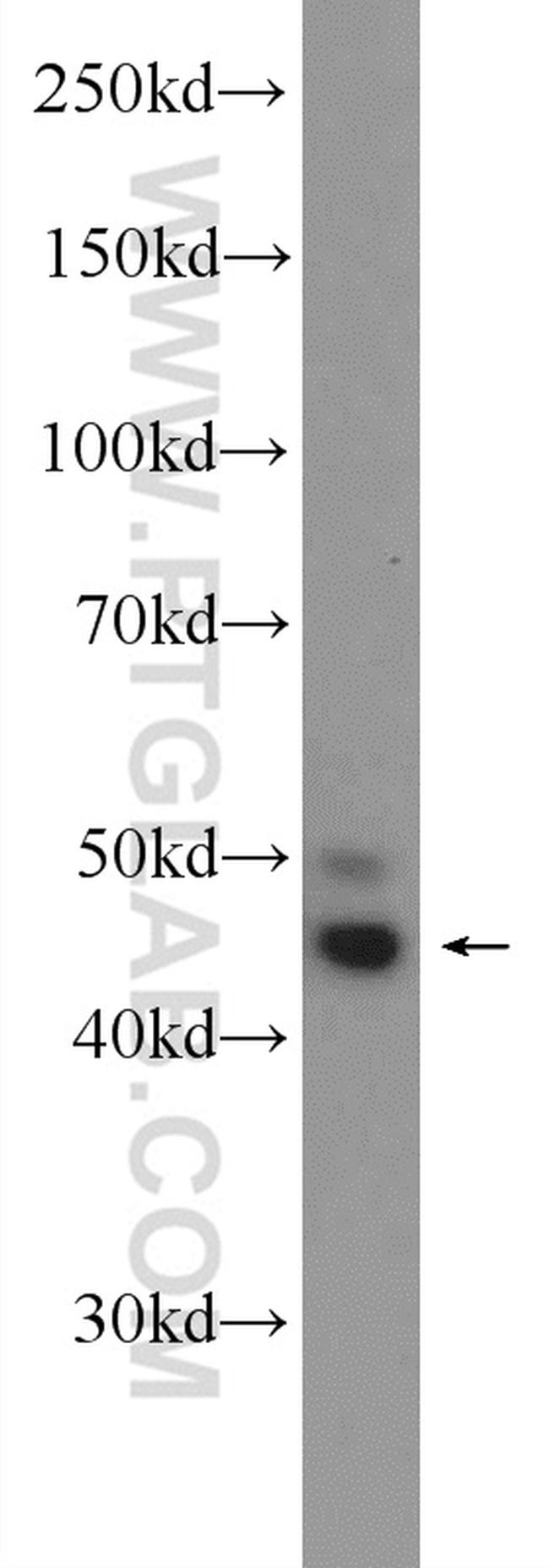 WNT5A/B Antibody in Western Blot (WB)