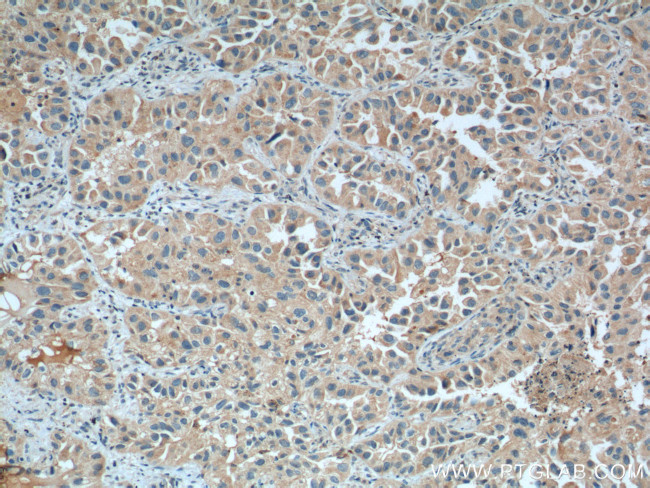 WNT5A/B Antibody in Immunohistochemistry (Paraffin) (IHC (P))