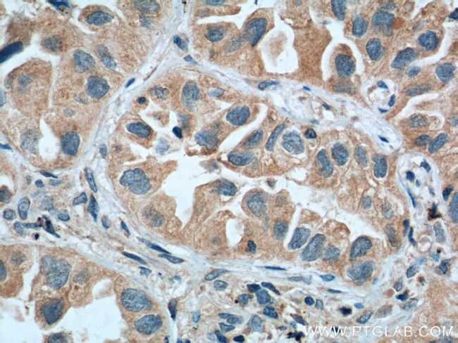 WNT5A/B Antibody in Immunohistochemistry (Paraffin) (IHC (P))