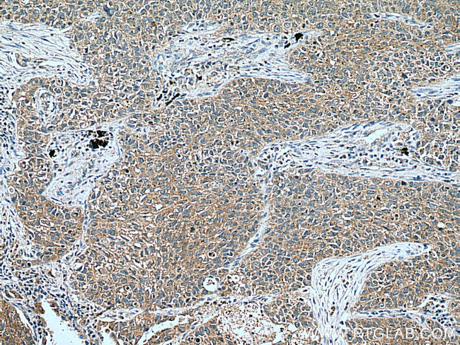 WNT5A/B Antibody in Immunohistochemistry (Paraffin) (IHC (P))