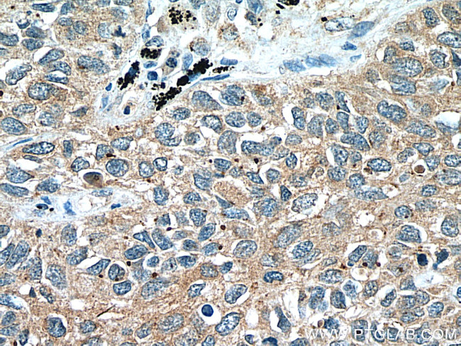 WNT5A/B Antibody in Immunohistochemistry (Paraffin) (IHC (P))