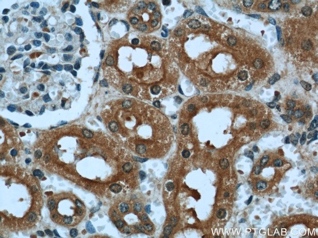 DARC Antibody in Immunohistochemistry (Paraffin) (IHC (P))