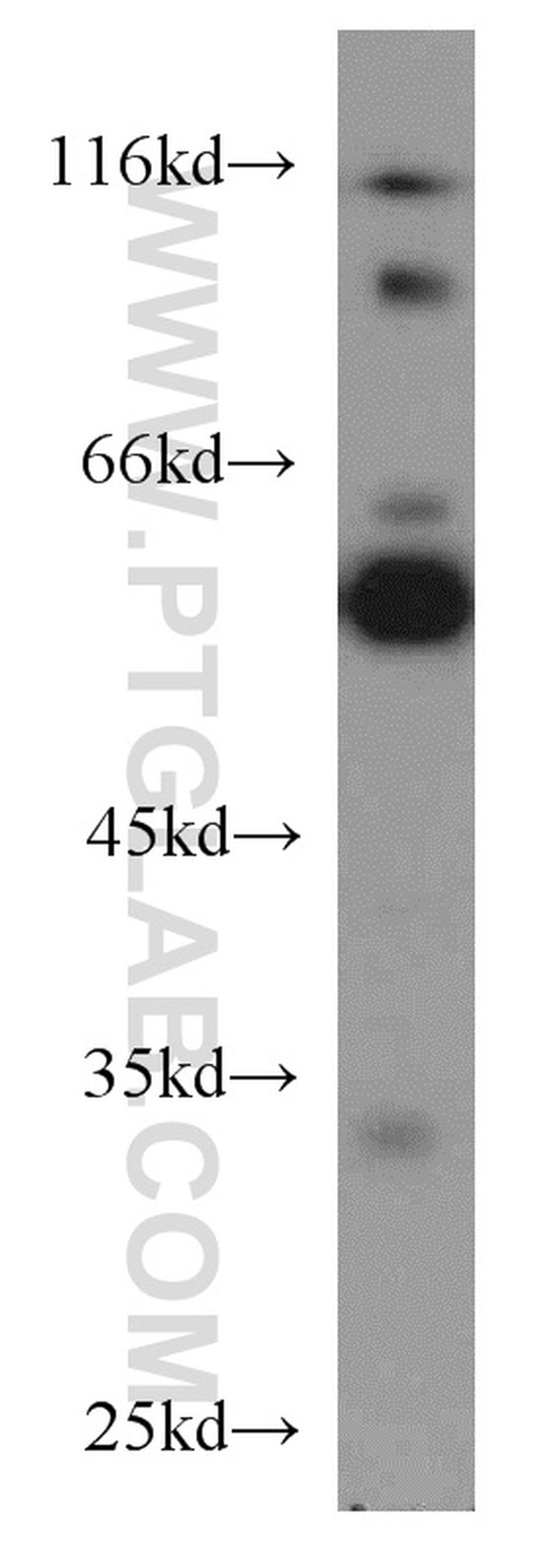 PTBP2 Antibody in Western Blot (WB)