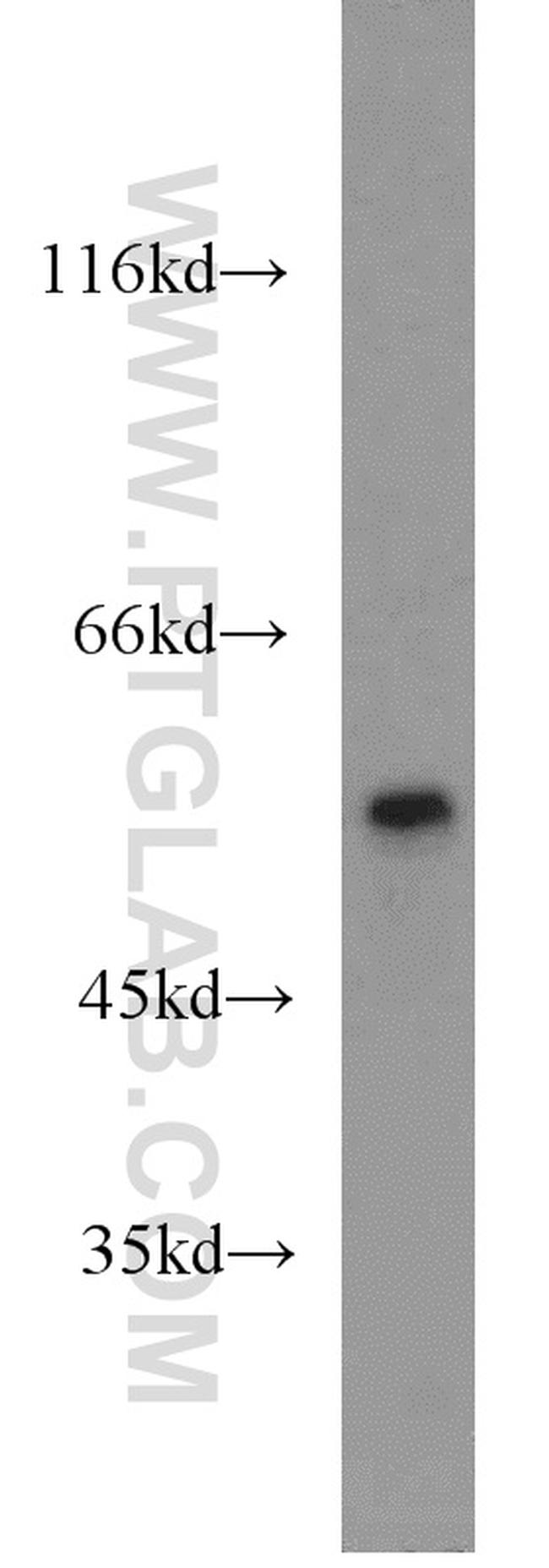 PTBP2 Antibody in Western Blot (WB)