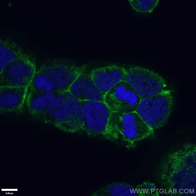 ATP1A1 Antibody in Immunocytochemistry (ICC/IF)