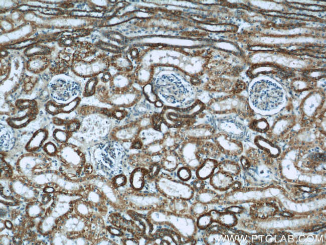 ATP1A1 Antibody in Immunohistochemistry (Paraffin) (IHC (P))