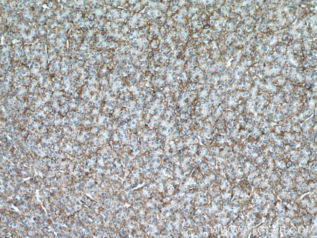 ATP1A1 Antibody in Immunohistochemistry (Paraffin) (IHC (P))