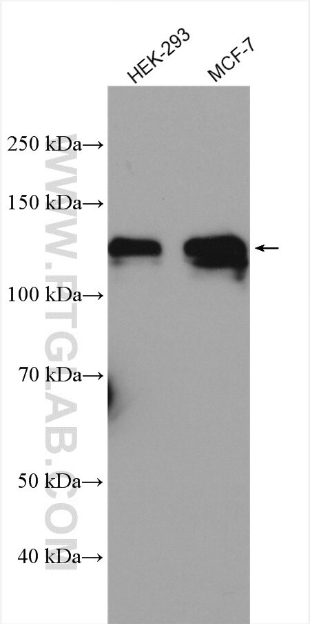 ATP1A1 Antibody in Western Blot (WB)