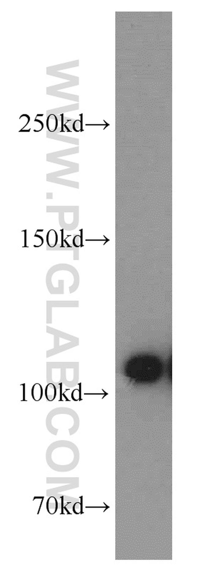 ATP1A1 Antibody in Western Blot (WB)