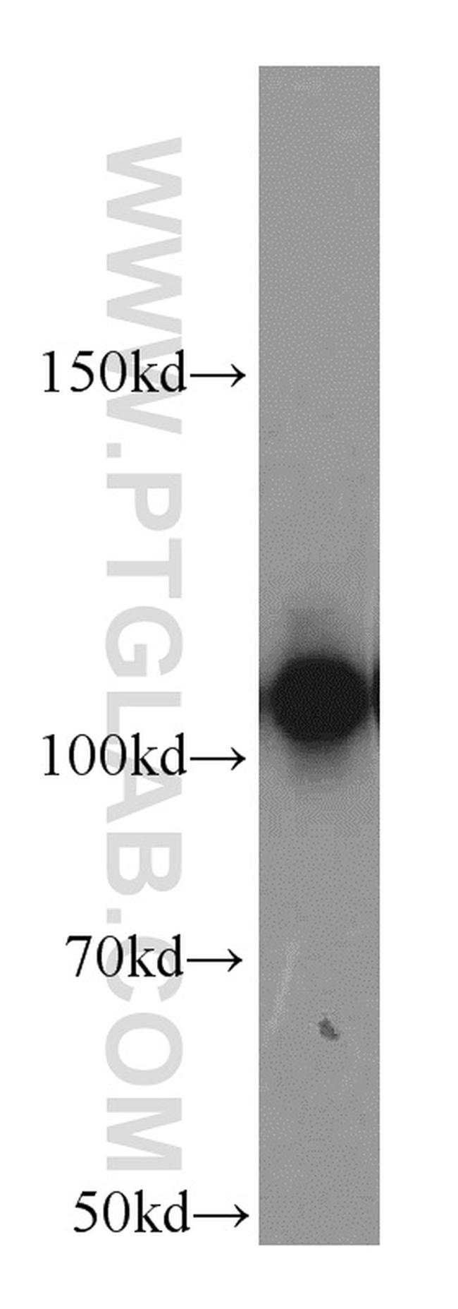 ATP1A1 Antibody in Western Blot (WB)