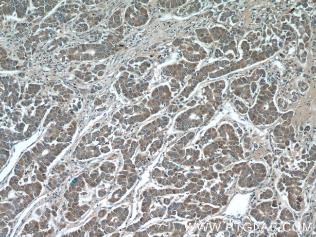 IQGAP2 Antibody in Immunohistochemistry (Paraffin) (IHC (P))