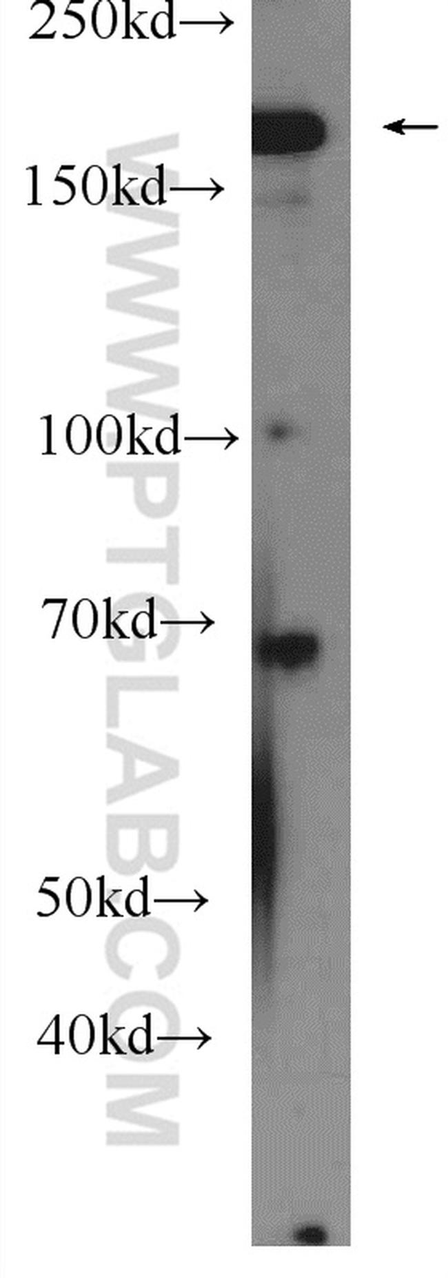 IQGAP2 Antibody in Western Blot (WB)