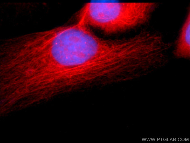 ATGL Antibody in Immunocytochemistry (ICC/IF)