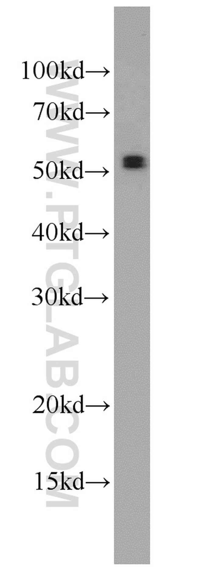 ATGL Antibody in Western Blot (WB)