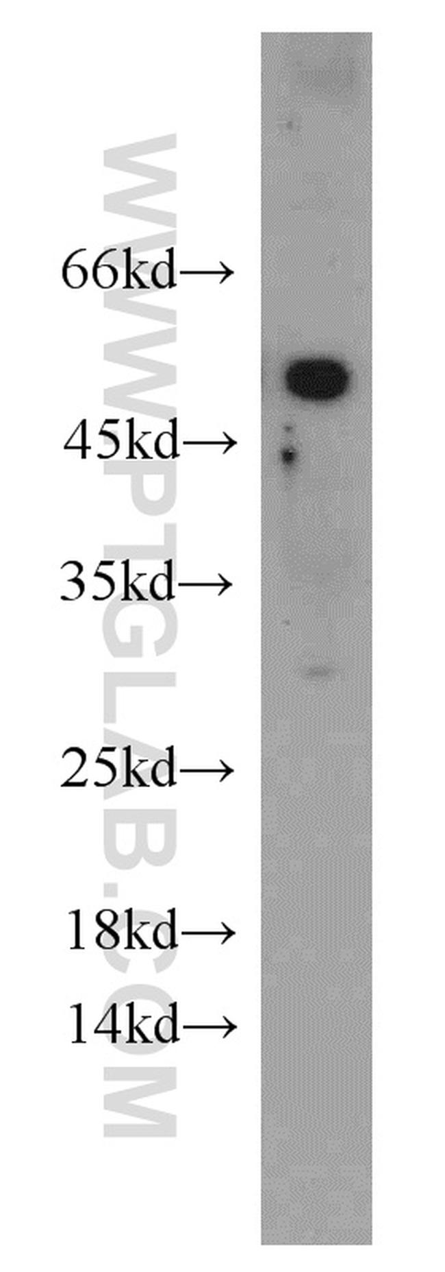 ATGL Antibody in Western Blot (WB)