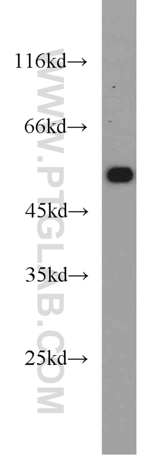 ATGL Antibody in Western Blot (WB)