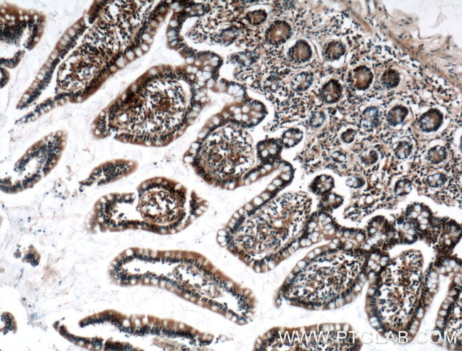 EWS Antibody in Immunohistochemistry (Paraffin) (IHC (P))