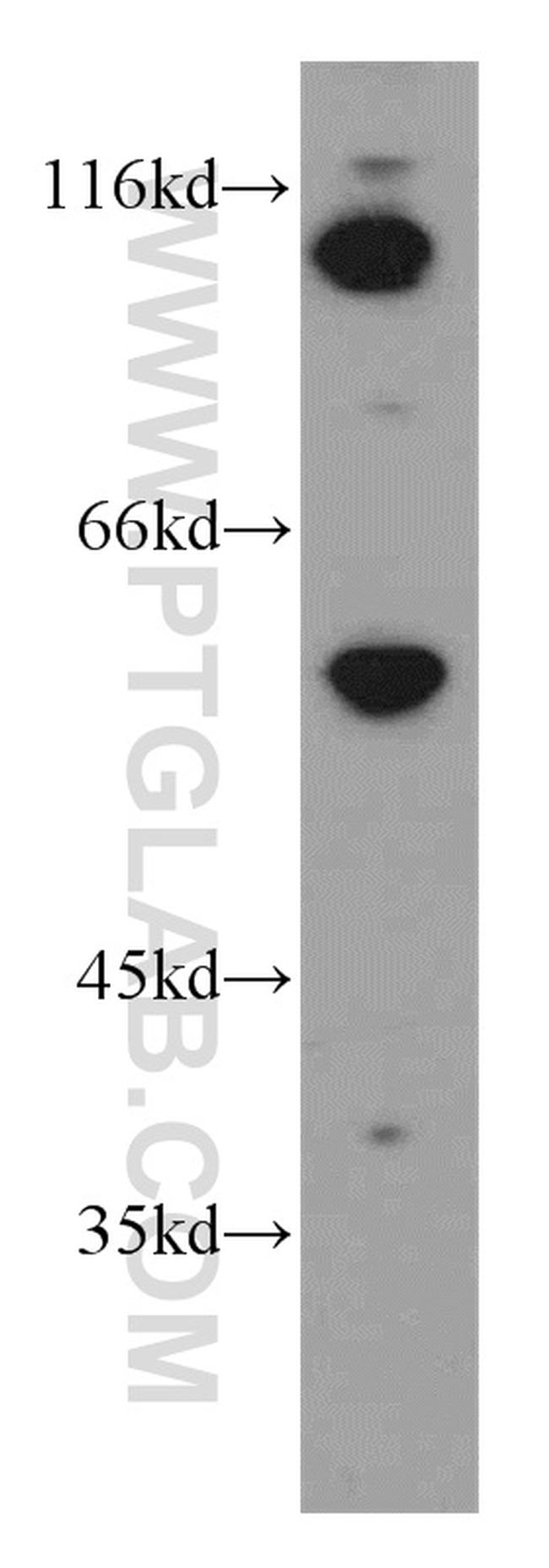 EWS Antibody in Western Blot (WB)