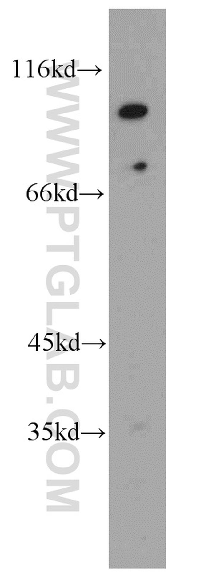 EWS Antibody in Western Blot (WB)