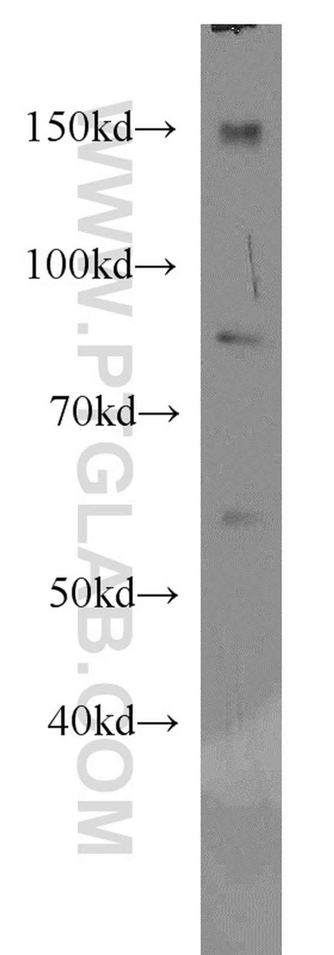 EWS Antibody in Western Blot (WB)