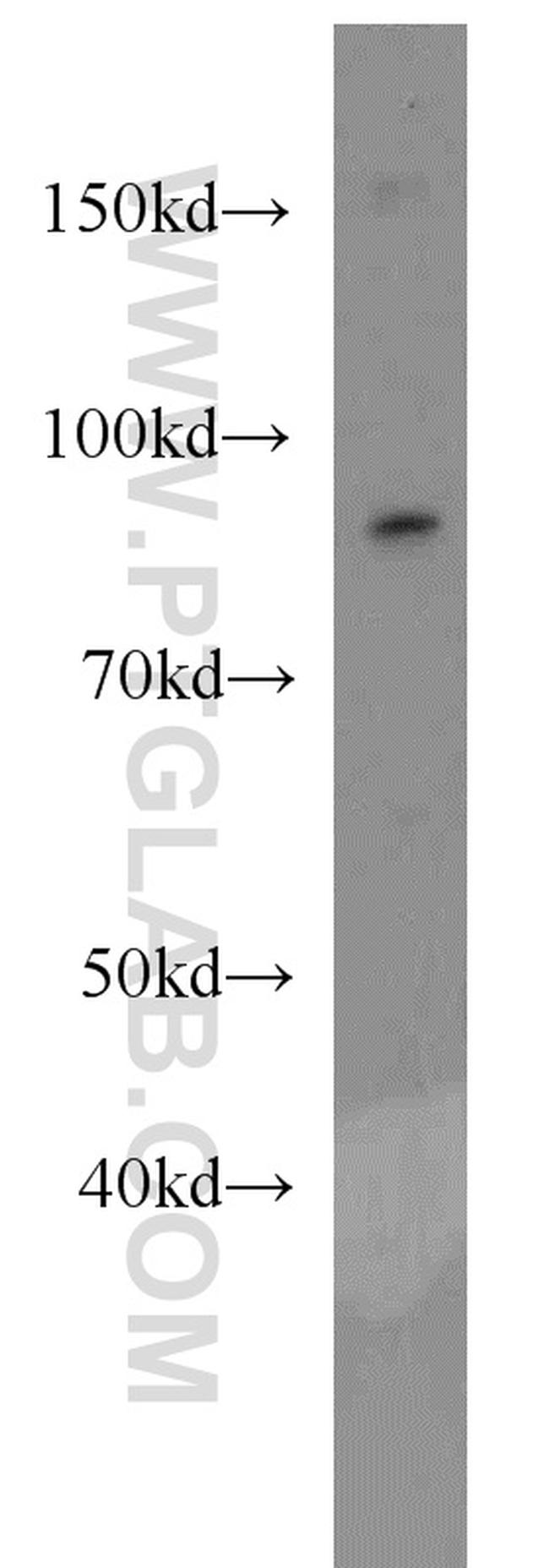 EWS Antibody in Western Blot (WB)