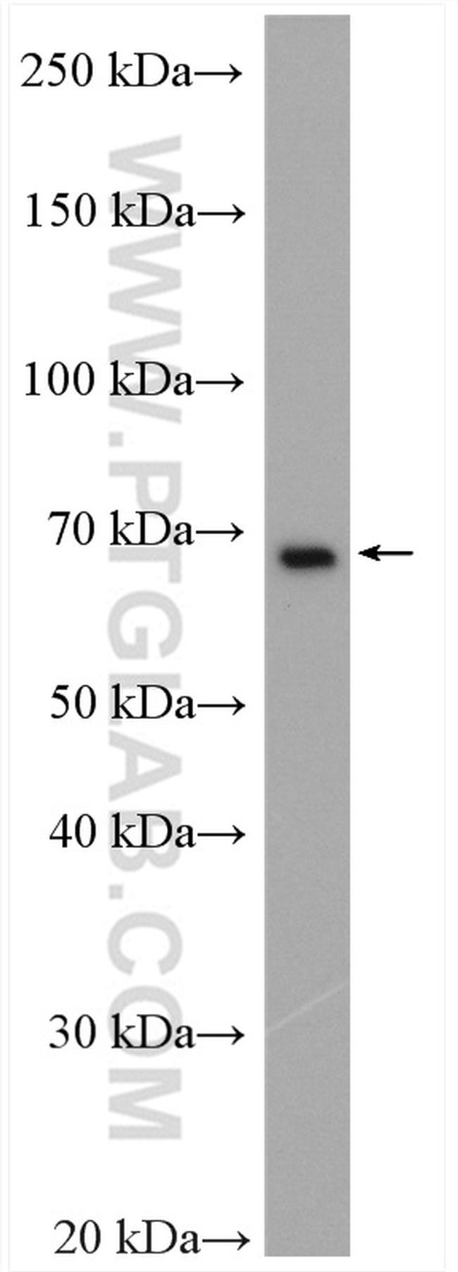 EWS Antibody in Western Blot (WB)