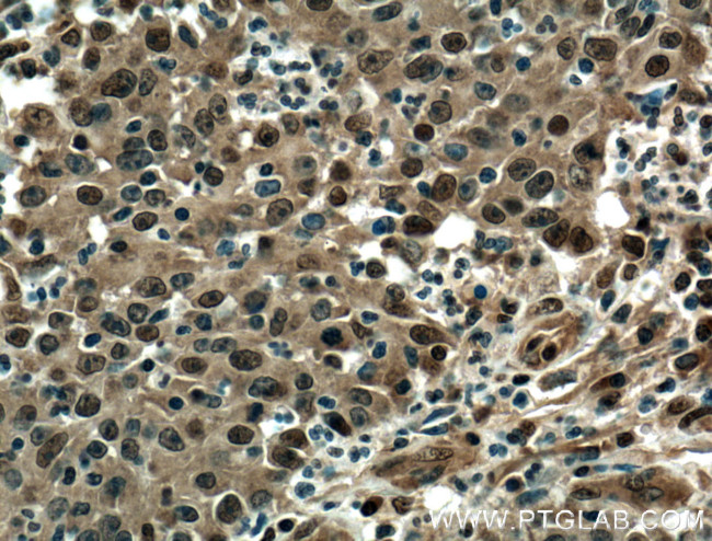 EWS Antibody in Immunohistochemistry (Paraffin) (IHC (P))