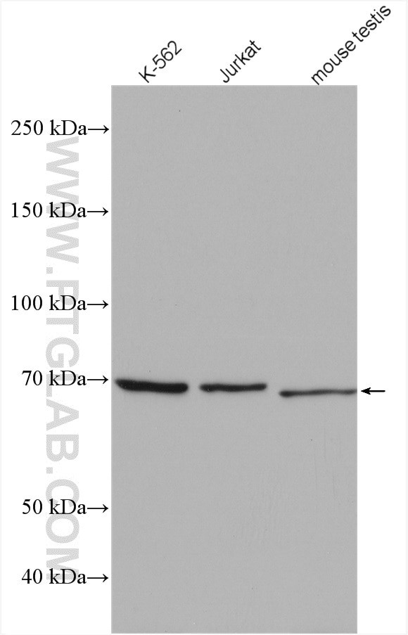 EWS Antibody in Western Blot (WB)