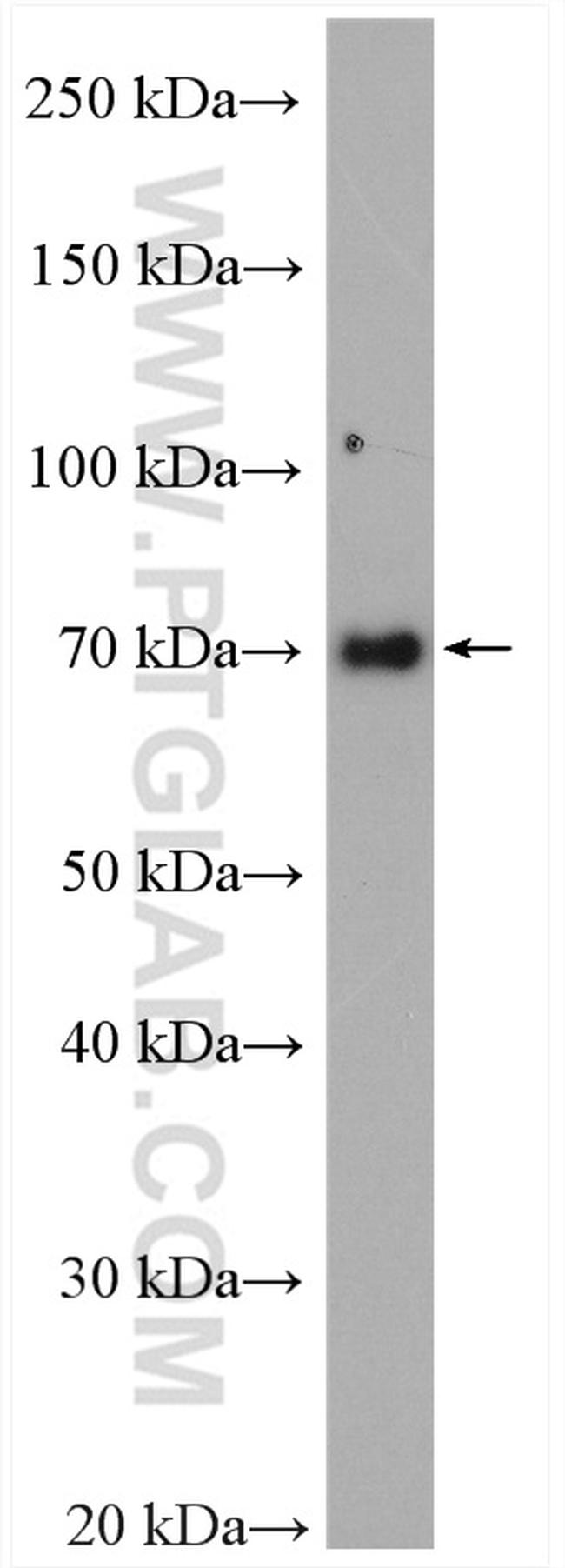 EWS Antibody in Western Blot (WB)