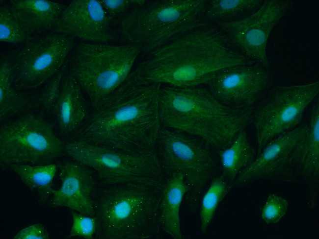 CSNK1A1 Antibody in Immunocytochemistry (ICC/IF)