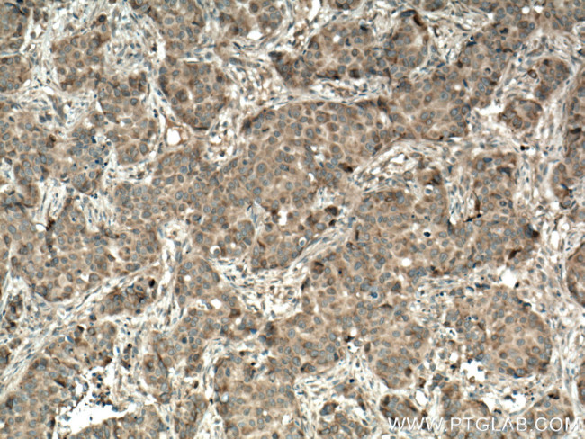 CSNK1A1 Antibody in Immunohistochemistry (Paraffin) (IHC (P))