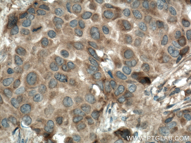 CSNK1A1 Antibody in Immunohistochemistry (Paraffin) (IHC (P))