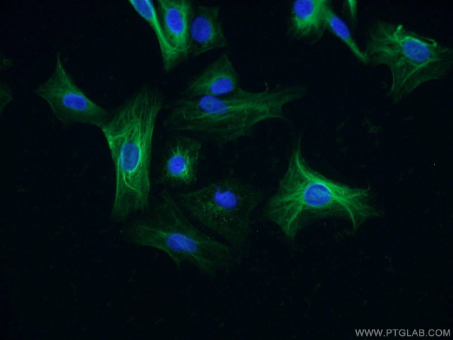 CSNK1A1 Antibody in Immunocytochemistry (ICC/IF)