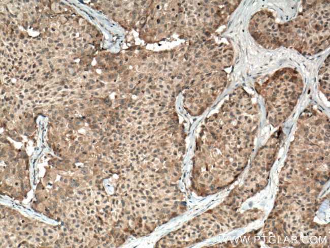 CSNK1A1 Antibody in Immunohistochemistry (Paraffin) (IHC (P))