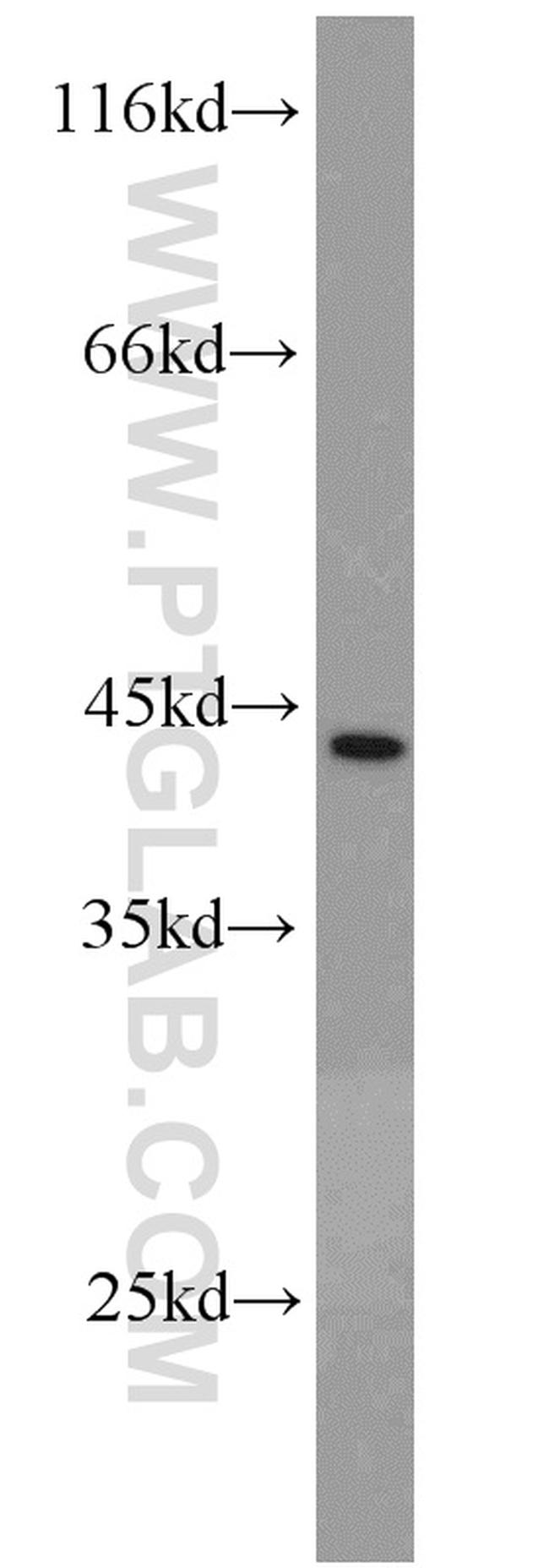 CSNK1A1 Antibody in Western Blot (WB)