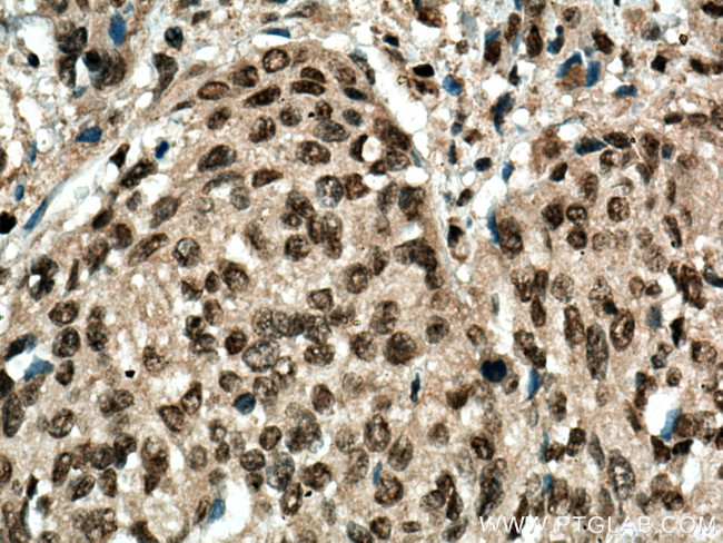 MBD2 Antibody in Immunohistochemistry (Paraffin) (IHC (P))