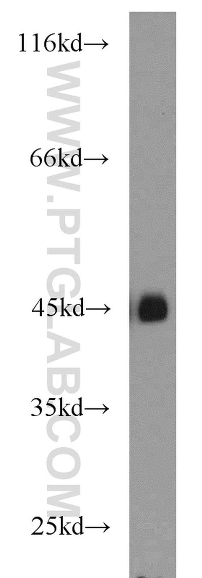 MBD2 Antibody in Western Blot (WB)