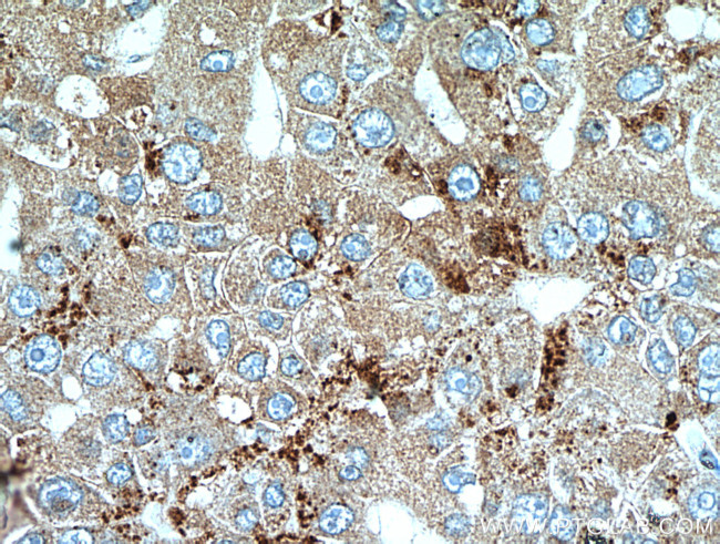 SET Antibody in Immunohistochemistry (Paraffin) (IHC (P))