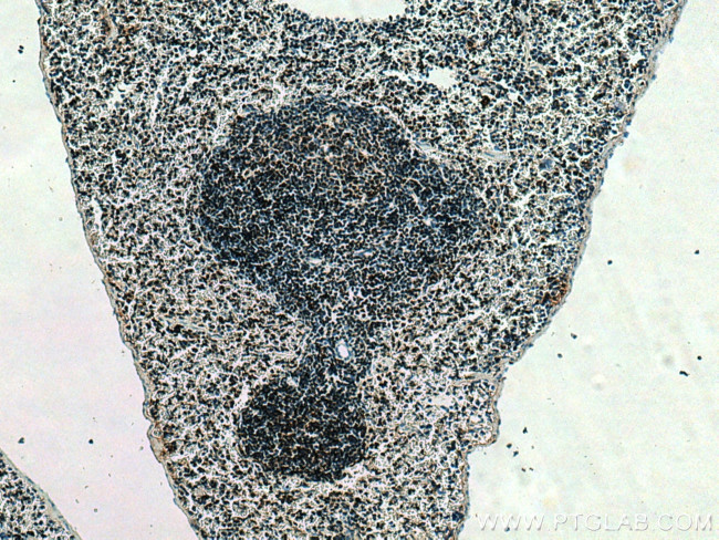 SET Antibody in Immunohistochemistry (Paraffin) (IHC (P))