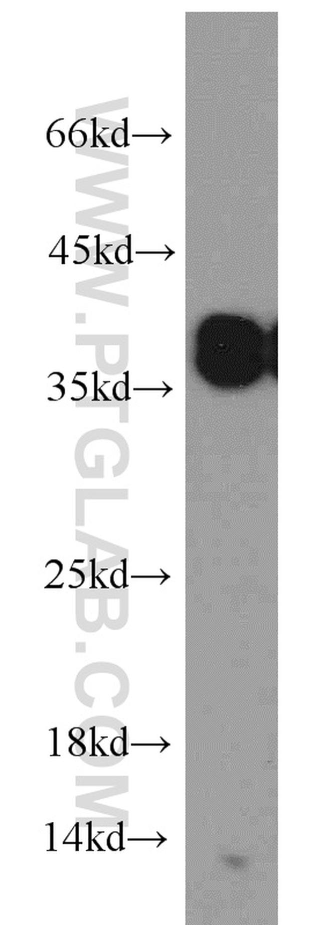 SET Antibody in Western Blot (WB)