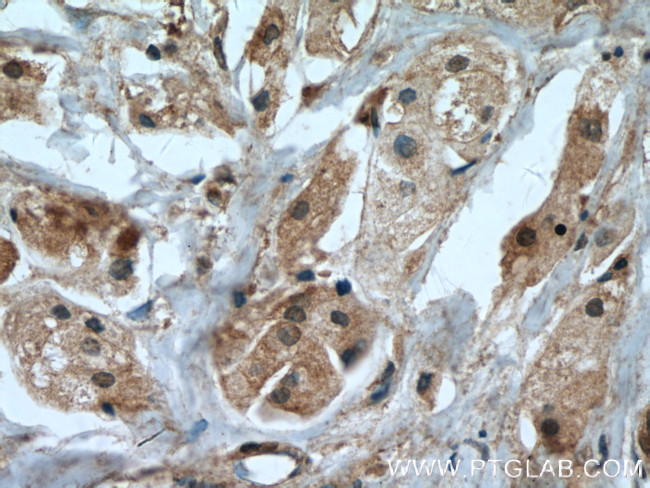 IGFBP5 Antibody in Immunohistochemistry (Paraffin) (IHC (P))