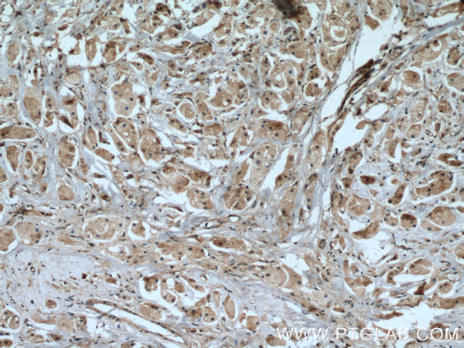 IGFBP5 Antibody in Immunohistochemistry (Paraffin) (IHC (P))