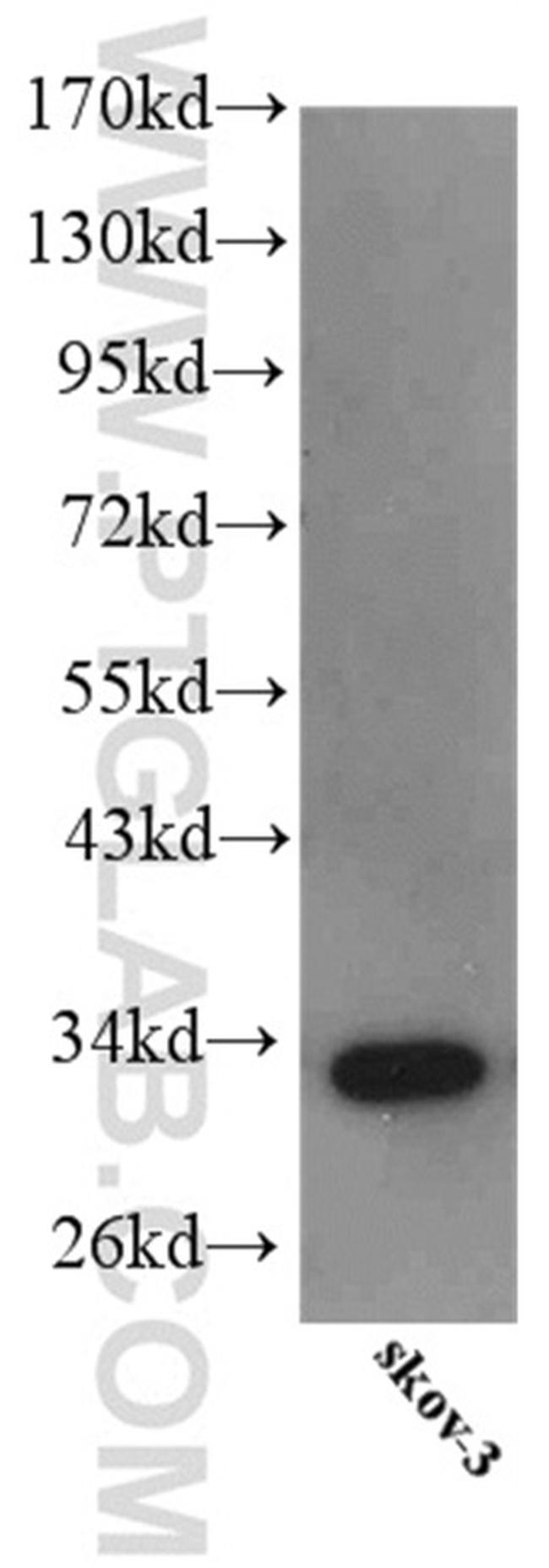 IGFBP5 Antibody in Western Blot (WB)