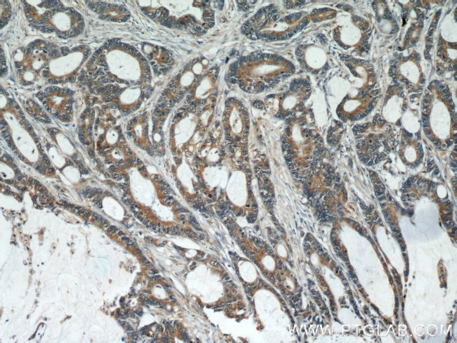 PCSK9 Antibody in Immunohistochemistry (Paraffin) (IHC (P))