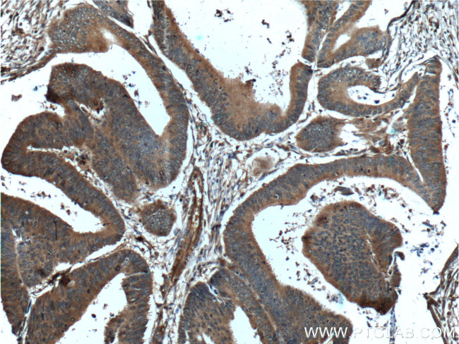 PCSK9 Antibody in Immunohistochemistry (Paraffin) (IHC (P))