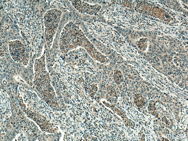 PCSK9 Antibody in Immunohistochemistry (Paraffin) (IHC (P))