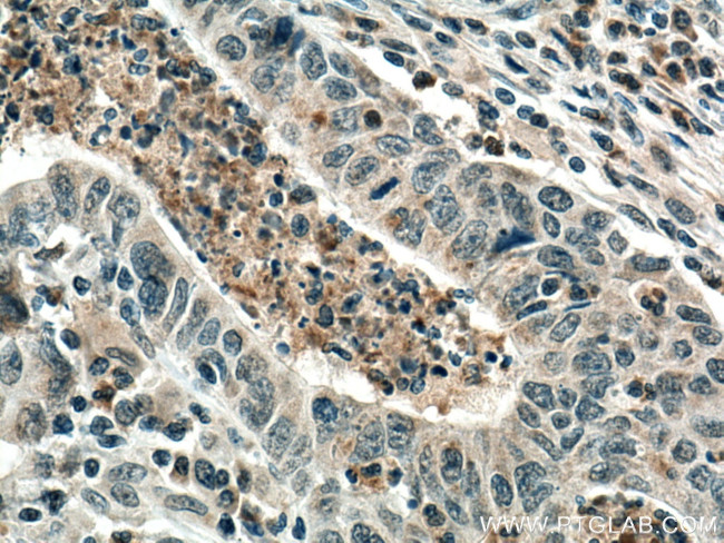 PCSK9 Antibody in Immunohistochemistry (Paraffin) (IHC (P))