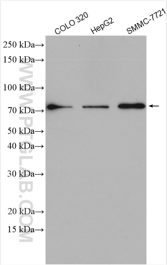 PCSK9 Antibody in Western Blot (WB)